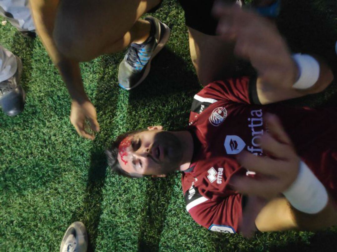 Héctor Pizana, instantes después de recibir el impacto en la cabeza