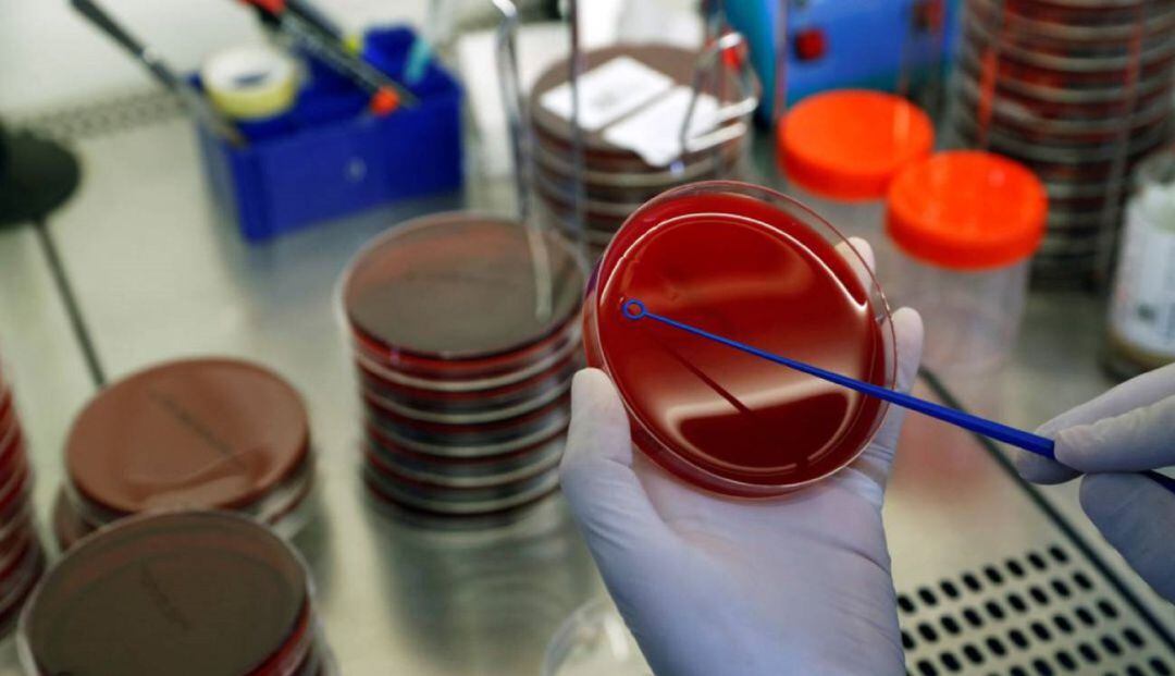 Un análisis en un laboratorio.