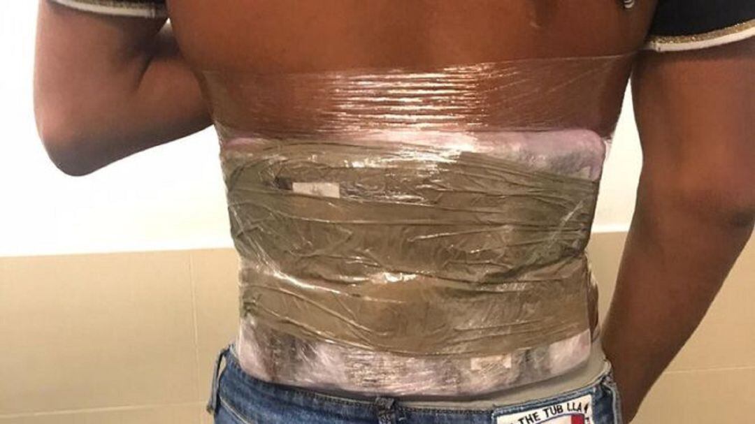 El menor con la droga alojada al cuerpo.