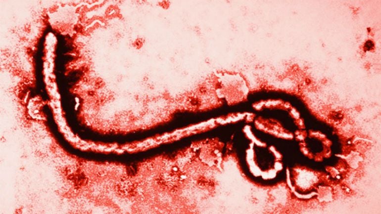 Virus del ébola