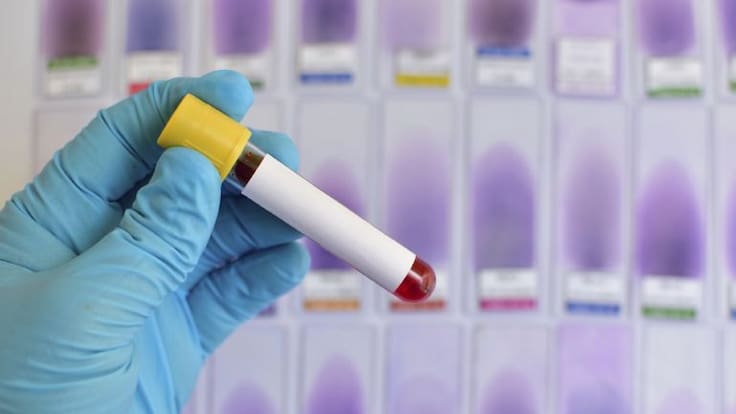 Entrevista La Ventana CV 28/02/2024