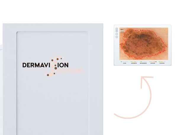 La cabina de Dermavision Solutions.