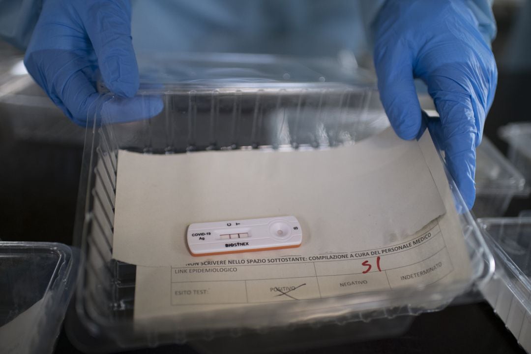 Una muestra de un test del coronavirus.