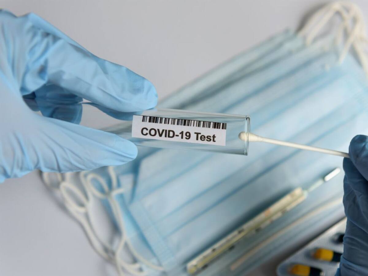 Andalucía baja 14 puntos su tasa de contagios de Covid-19 desde el jueves