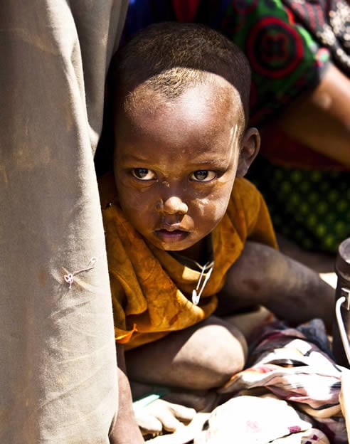 Un niño recién llegado al campo de refugiados de Dadaab, cerca de la frontera entre Kenia y Somalia, espera para ser sometido a los exámenes médicos