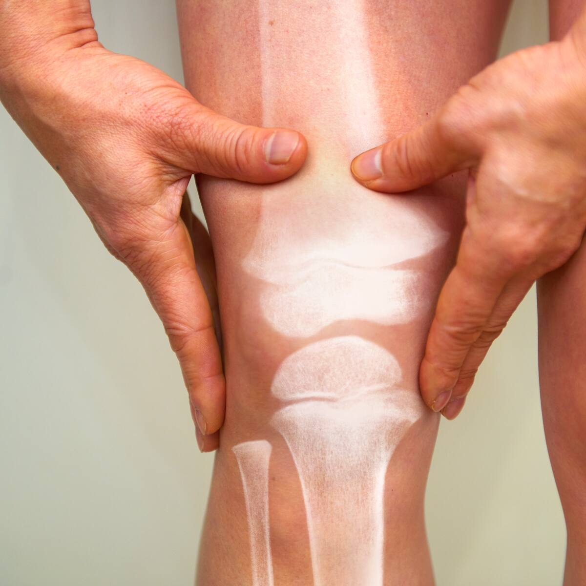 "La artrosis mata": qué debemos hacer para prevenir sus fatales consecuencias