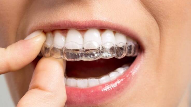 Entrevista con el Dr. Primitivo Pablo de la Quintana, Hospital Quirón