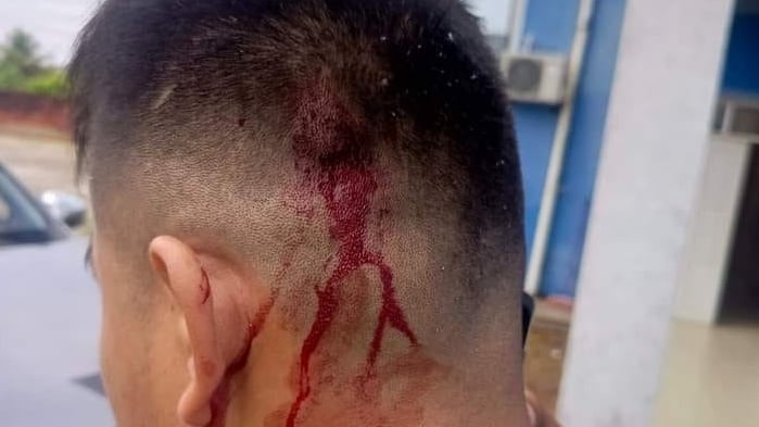 El conductor de Evo Morales, herido.