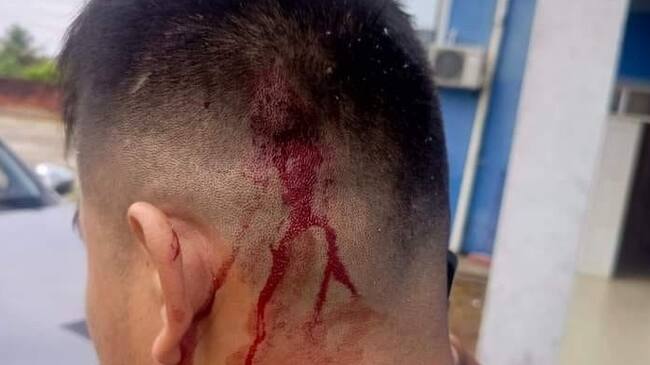 El conductor de Evo Morales, herido.