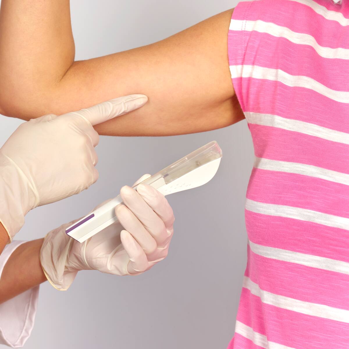 Implante anticonceptivo: dudas y beneficios