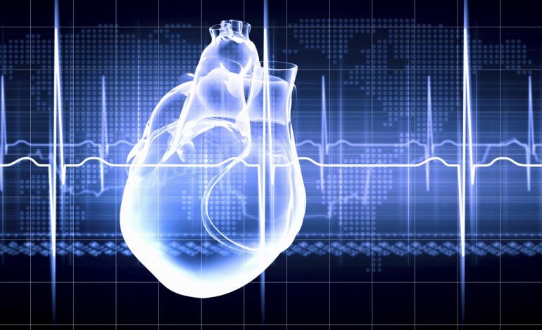 Infartos y derrames cerebrales, más del 50% de los accidentes laborales mortales