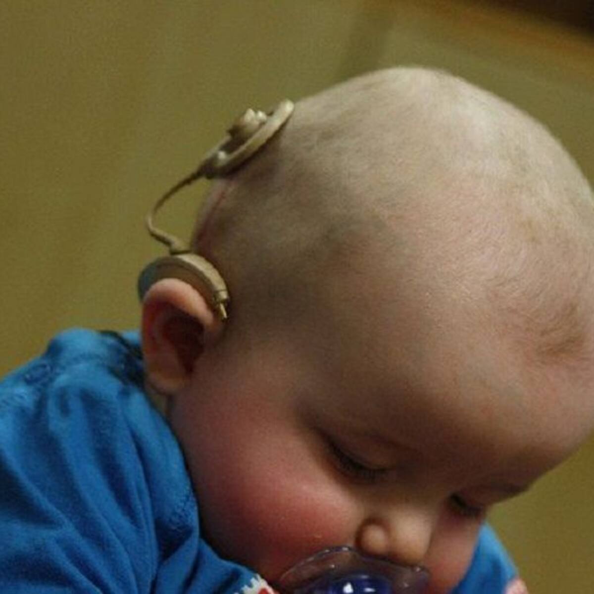 Doscientos implantes cocleares desde 2003