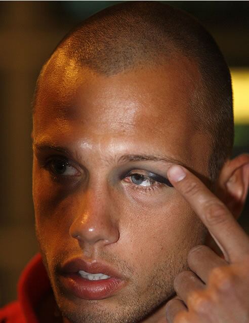 Heitinga se señala el ojo donde recibió el golpe a su llegada a Madrid