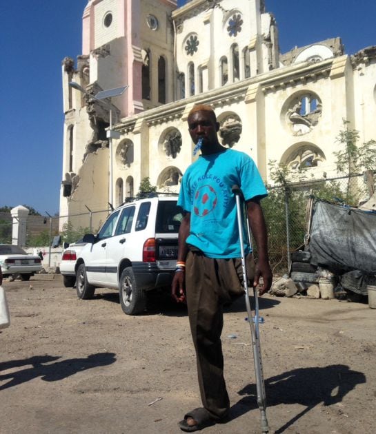 Icaris perdió su pierna izquierda al caerle encima una pared de su casa. Desde que salió del hospital vive en una chabola junto a las ruinas de la catedral de Puerto Príncipe