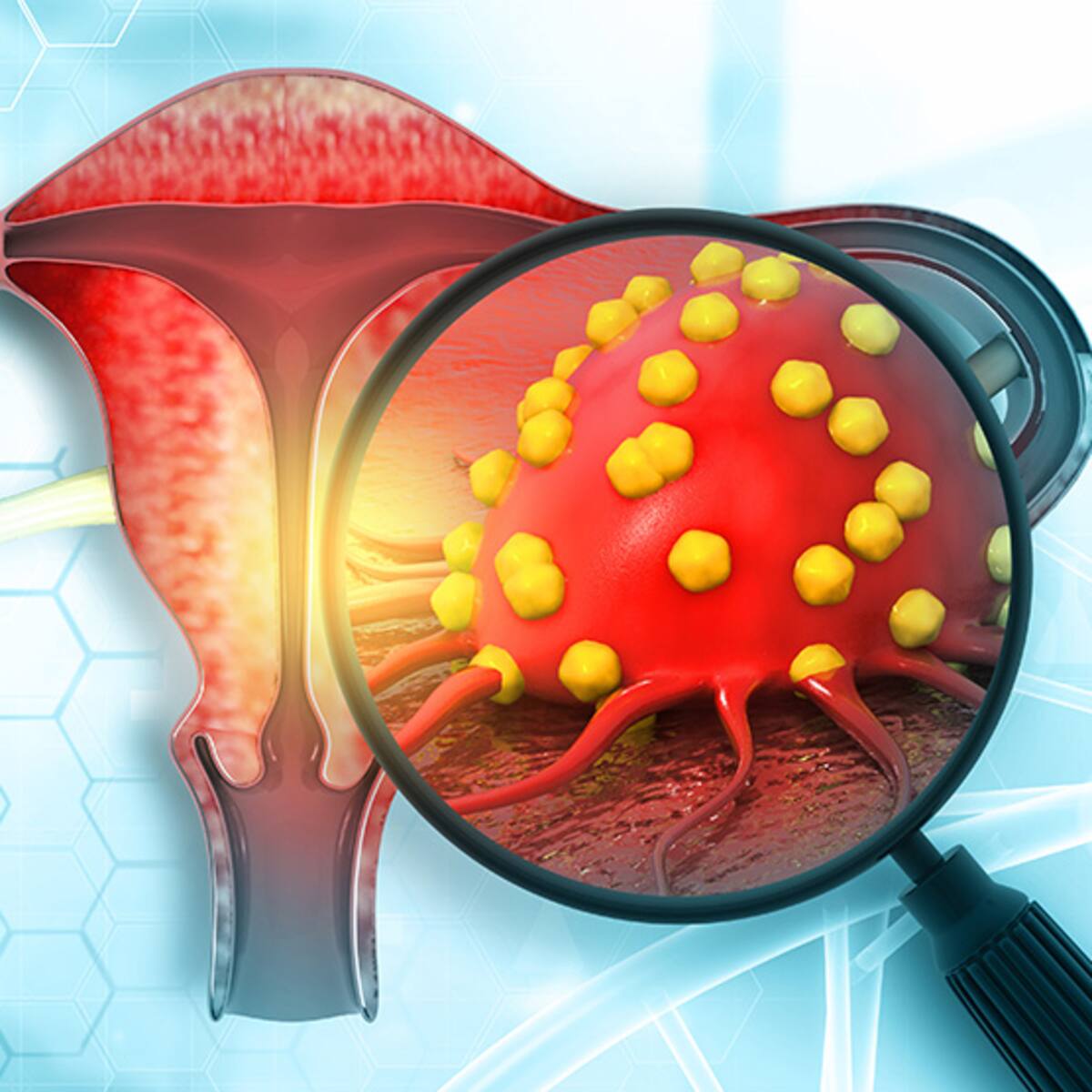 Más de setenta mujeres baleares contraen cada año un cáncer prevenible como el de cérvix