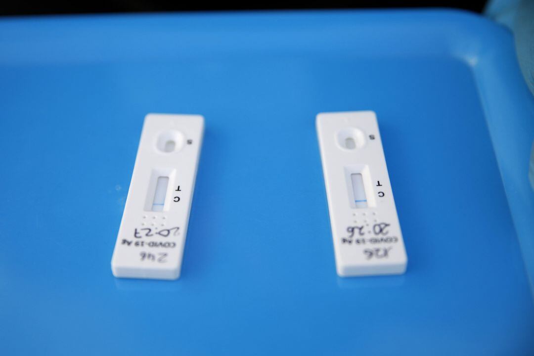 Test de antígenos, imagen de archivo