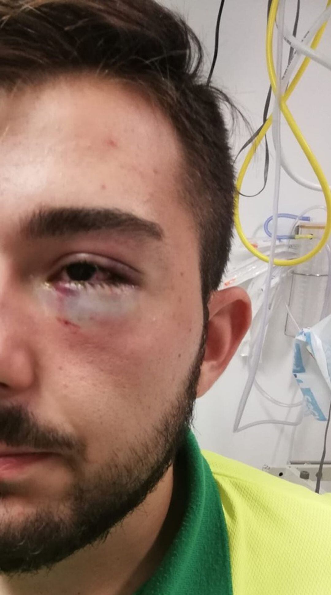 Estado del ojo del trabajador agredido