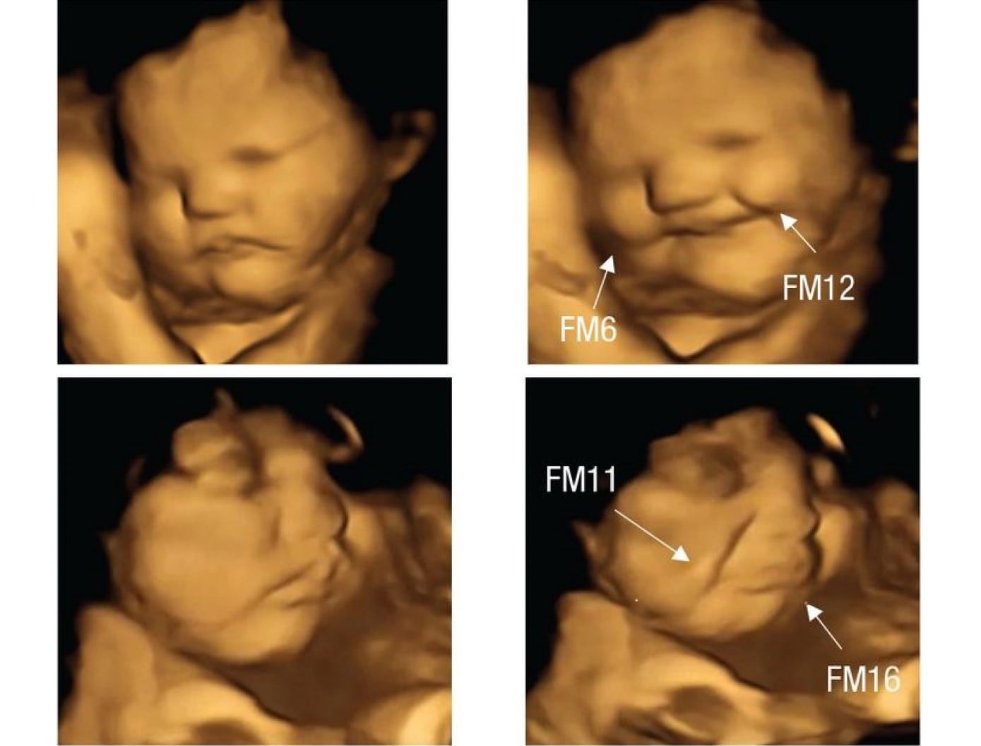 En las fotos de la parte superior, el bebé pasa de tener un gesto neutro a sonreír cuando la madre ingiere zanahoria. En las de la parte inferior, pasa lo contrario cuando come col rizada