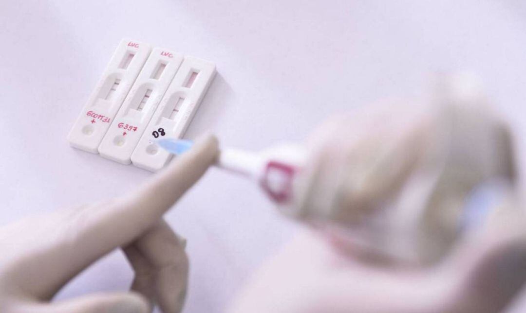 Imagen de test rápidos que se utilizan para detectar la Covid-19 