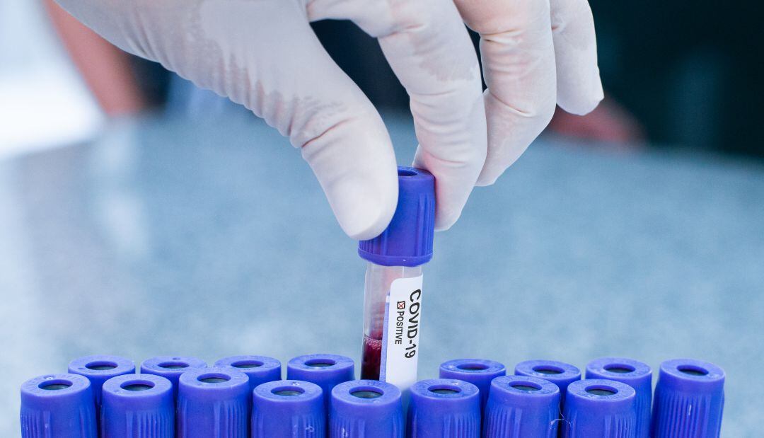 Castilla y León suma 29 casos positivos