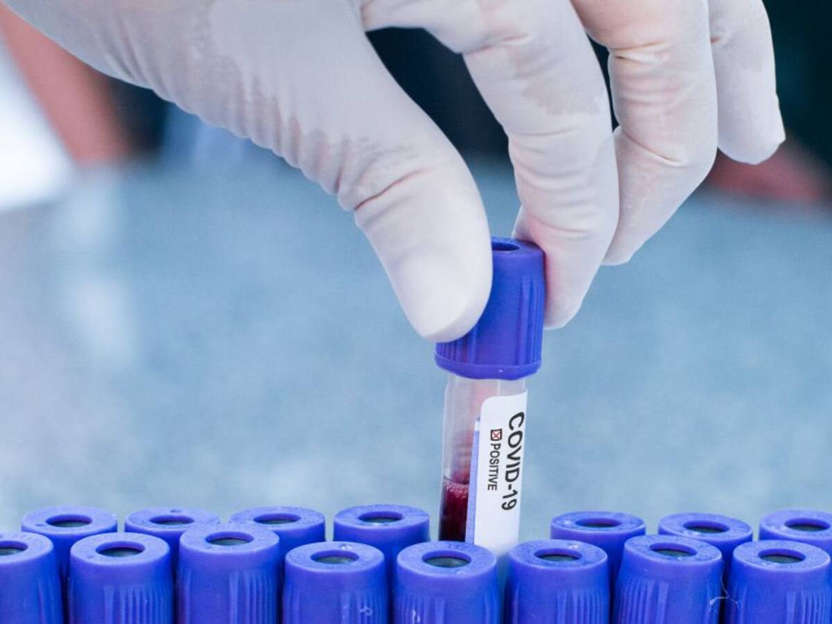 Castilla y León registra 29 nuevos positivos, dos fallecidos y doce nuevas altas