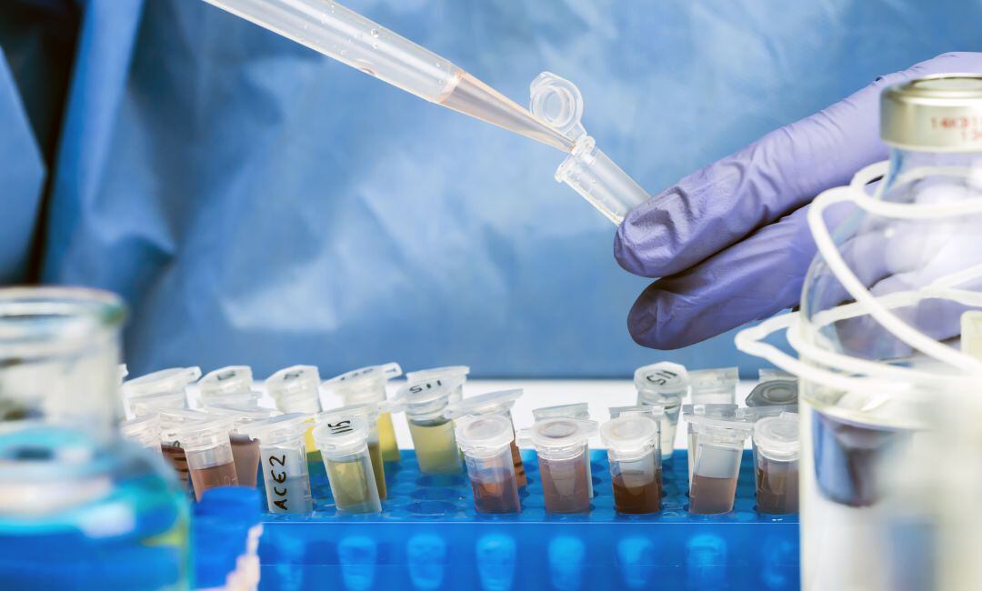 Un laboratorio con muestras de COVID-19.