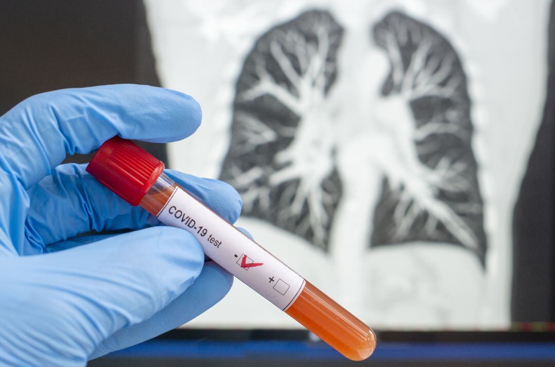 Cuatro nuevas áreas de salud de Palencia pasan a fase 1 la próxima semana