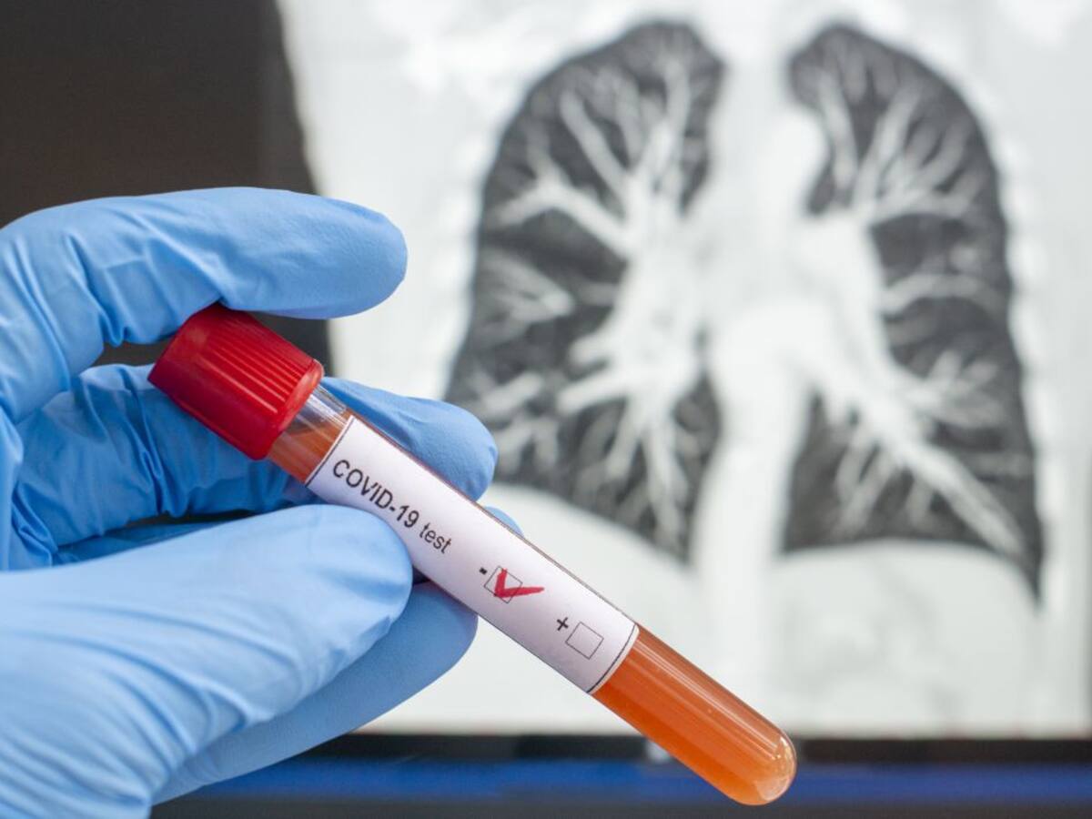 Cervera, Guardo, Paredes de Nava y Villamuriel propuestas para su pase a fase 1