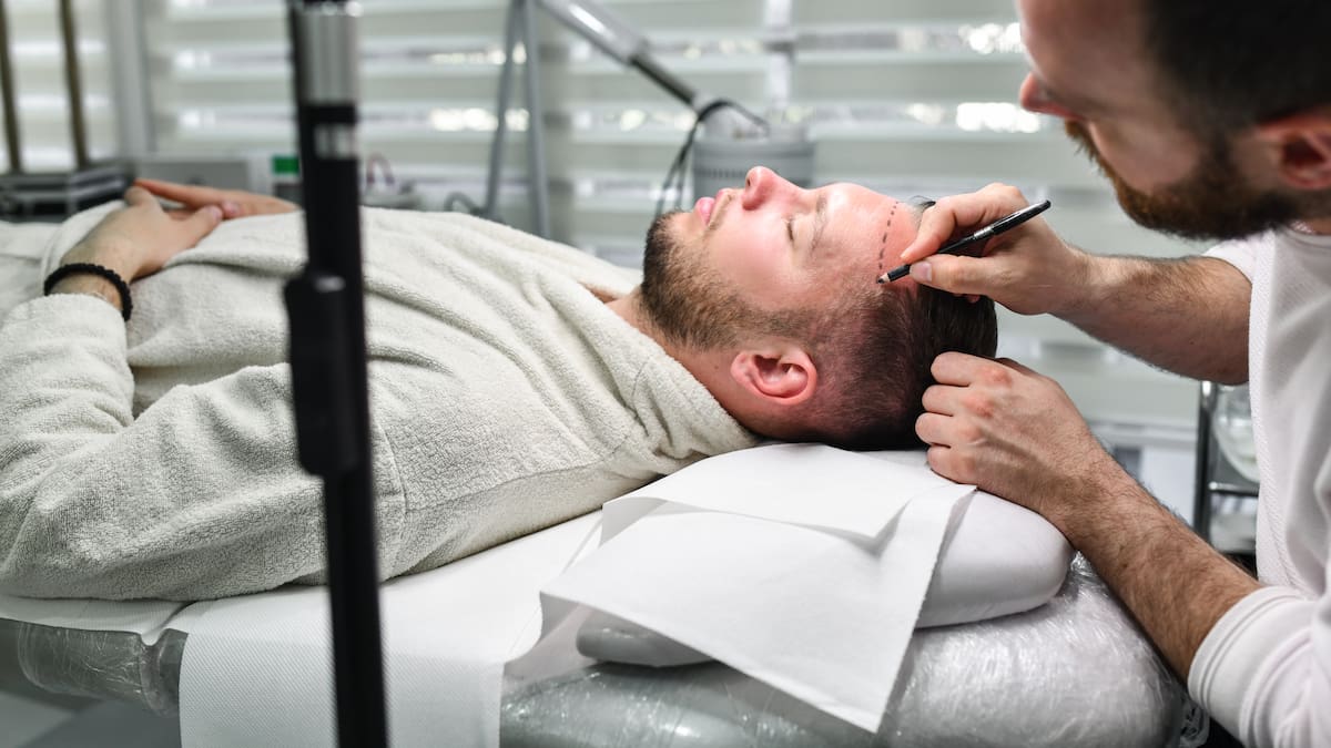 El peluquero de los políticos revela el truco para saber si alguien se ha puesto pelo o no: “Ese es que está recién repoblado”