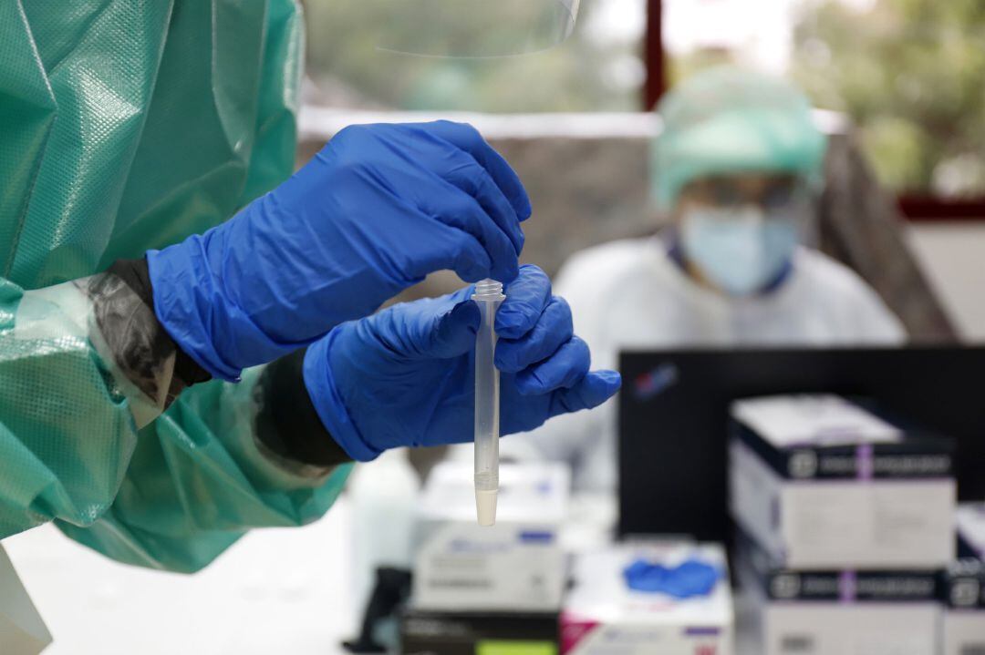 Pruebas de un cribado masivo de COVID-19