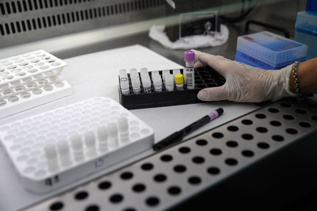 Muestras de pruebas PCR en un laboratorio.