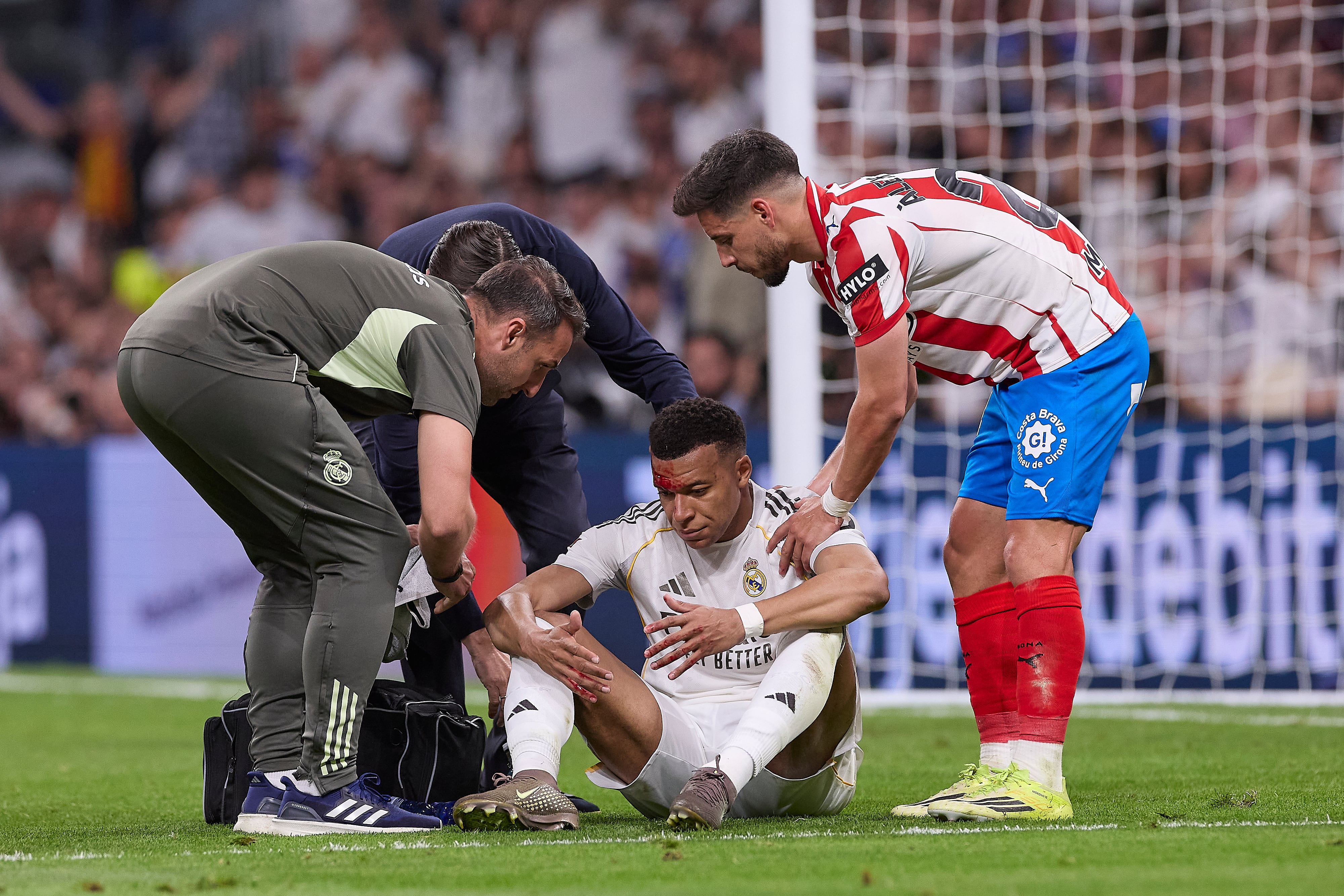 Mbappé con la cabeza sangrando mientras está siendo atendido
