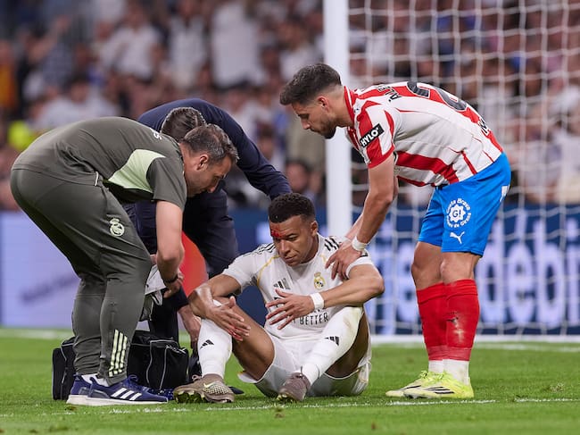 Mbappé con la cabeza sangrando mientras está siendo atendido