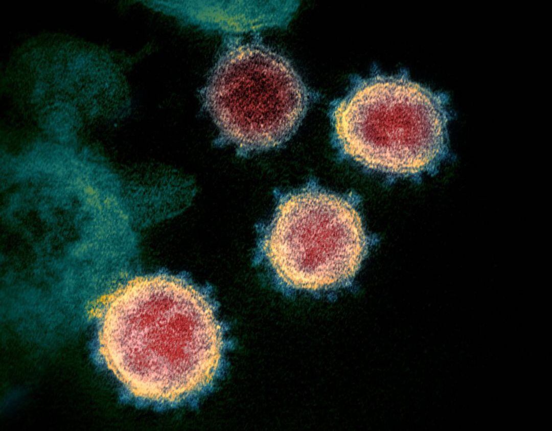 Imagen de microscopio electrónico del SARS-CoV-2, el virus que causa COVID-19, aislado de un paciente de EE.UU.