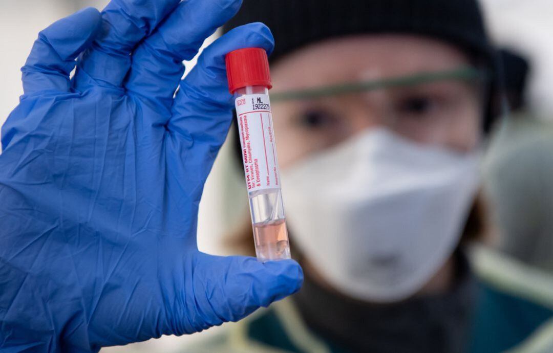 Test del coronavirus, que siguen sin penas hacerse en Zamora