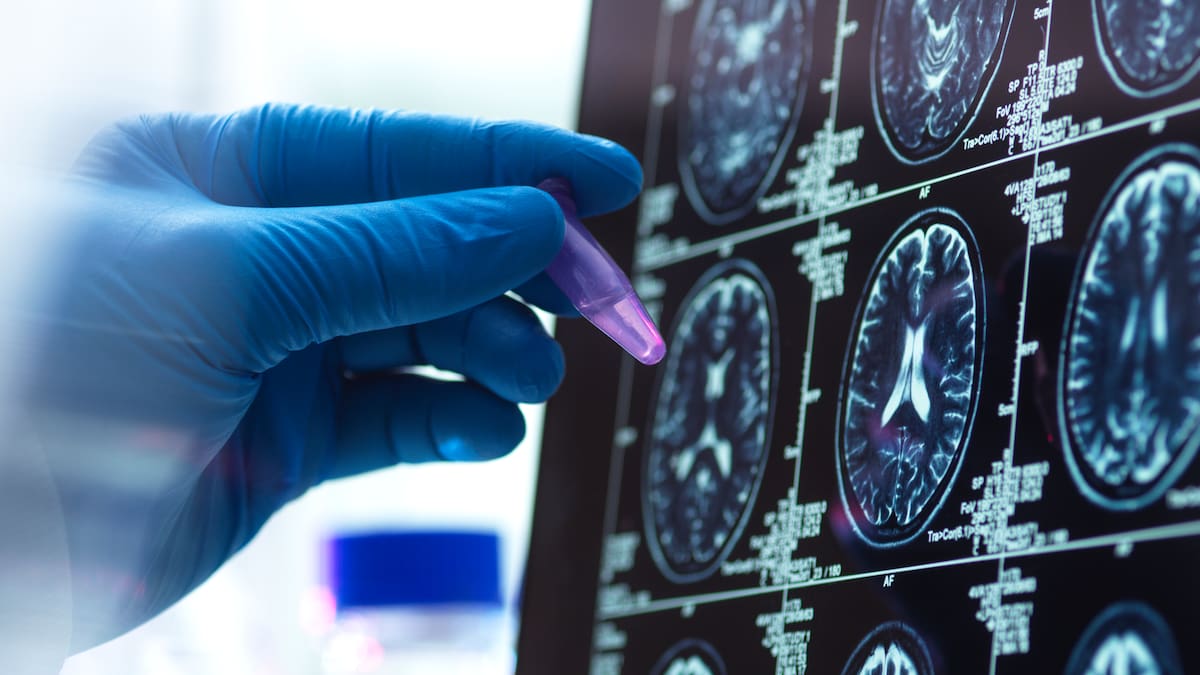 Un grupo de neurocientíficos crea minicerebros humanos y abren un dilema: "¿Podrán pensar?"