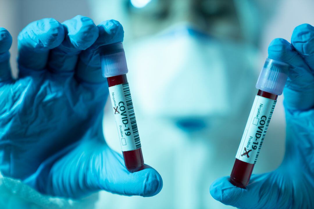 Asturias sigue situada como una de las comunidades con menor tasa de contacto con el virus.