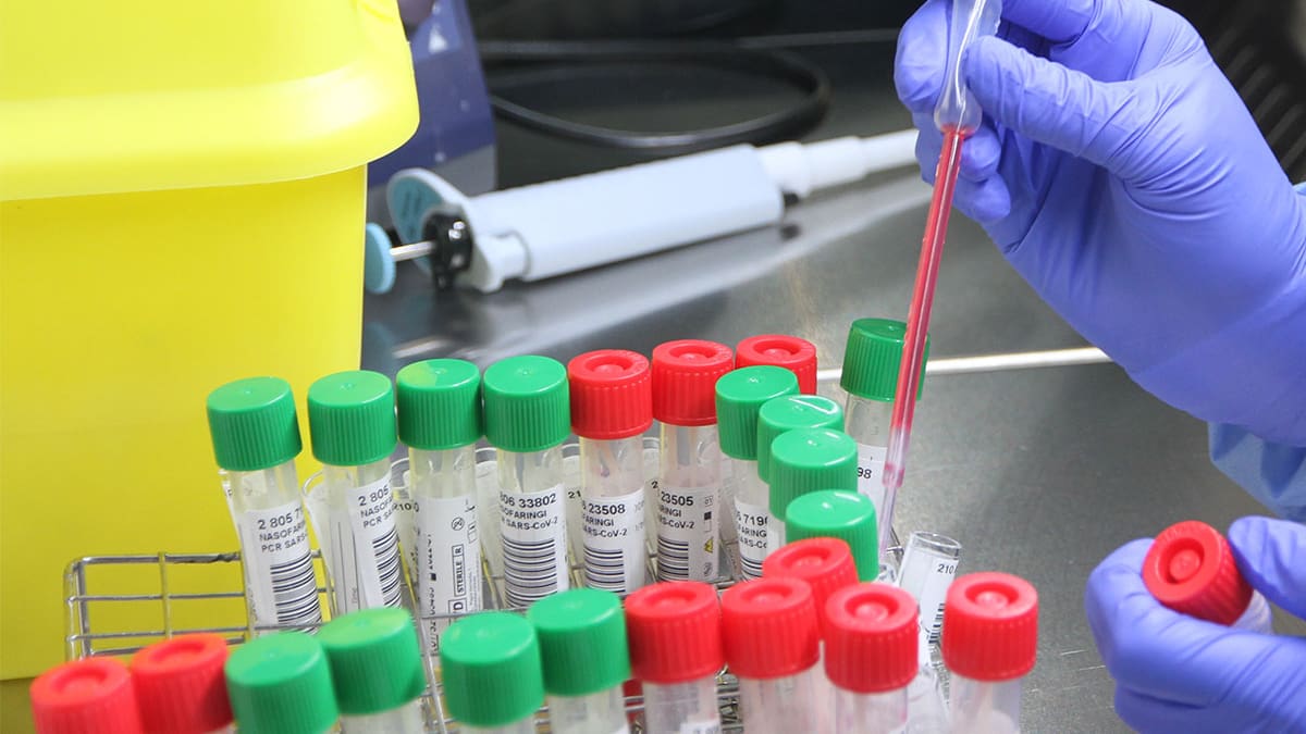 Suben los contagios y hospitalizados en el área de Vigo