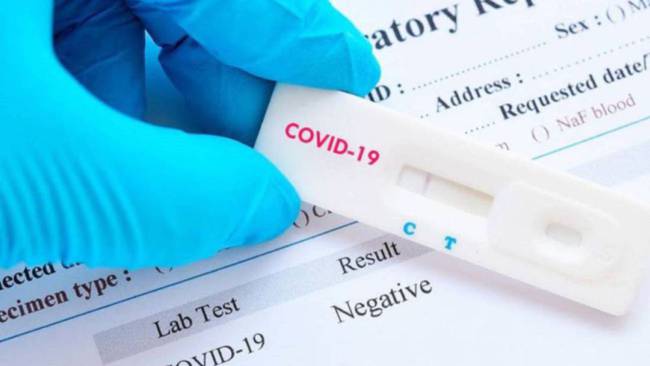 Test para detectar el coronavirus