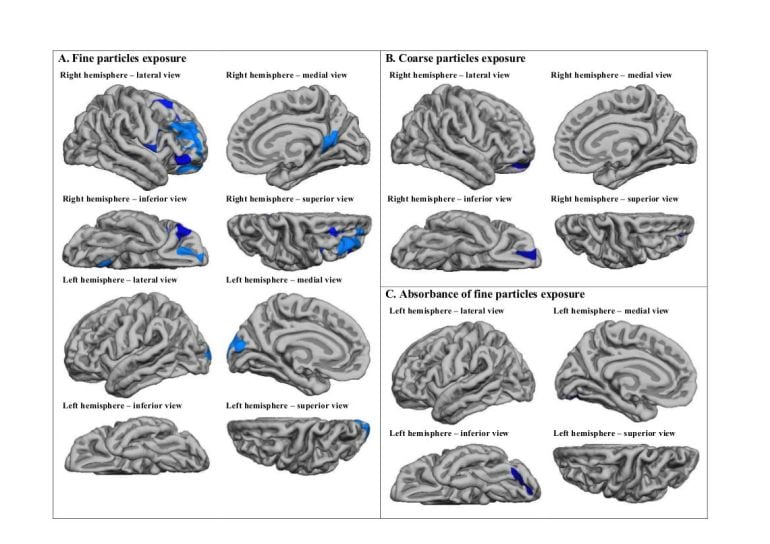 Esta imagen muestra las diferentes regiones del cerebro afectadas por contaminación del aire por partículas finas y gruesas que emiten, sobre todo, los coches.  
 