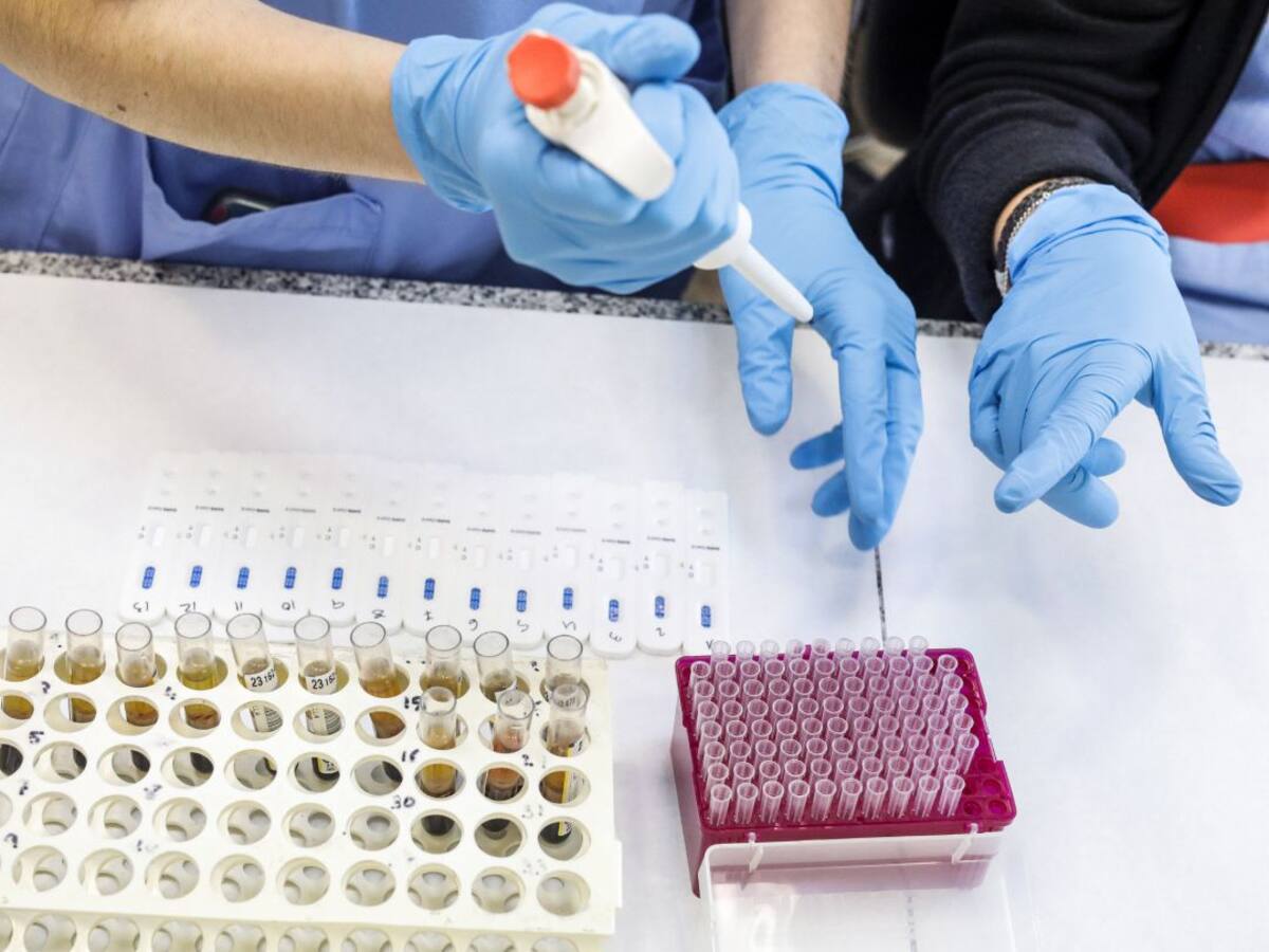 España calcula que puede recibir en diciembre 3 millones de dosis de la vacuna de la COVID