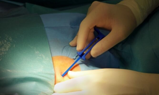 Imatge d'arxiu d'una intervenció cardíaca