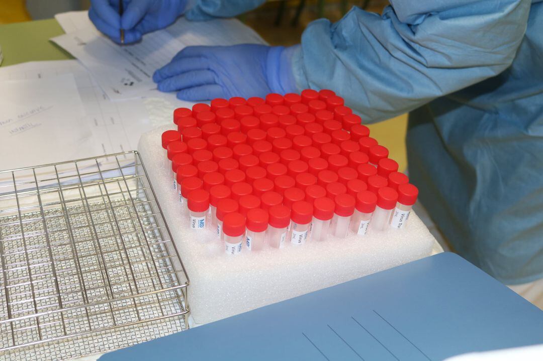 Recipientes para muestras de COVID-19.