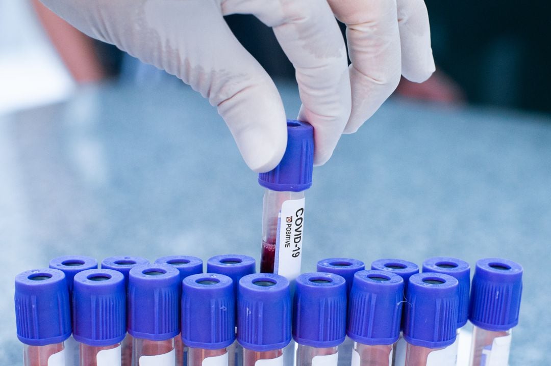 Desciende en seis el número de afectados por coronavirus en la región de Murcia