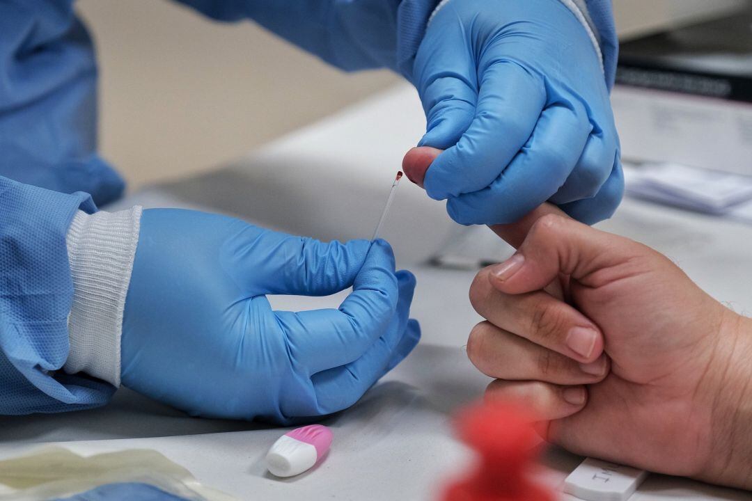 Prueba del Covid-19 de la Junta de Andalucía.