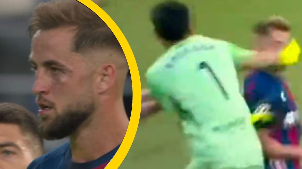 Terrible agresión en el Huesca-Zaragoza: el portero Andrada da un puñetazo a Pulido en la cara