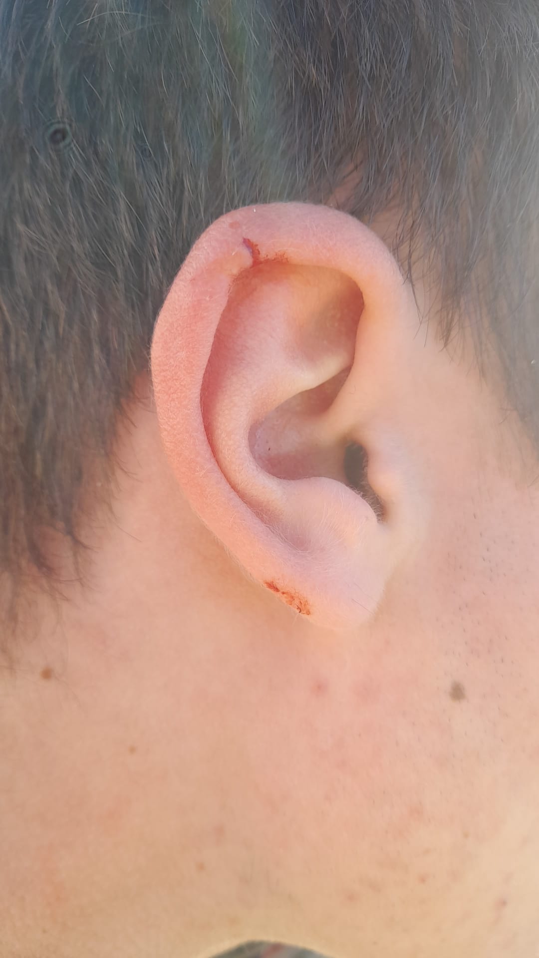 Oreja de Iker