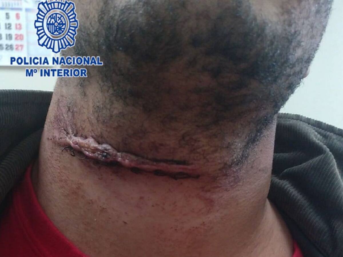 Detenido un gorrilla por tentativa de homicidio al herir a otro en el cuello con una botella rota