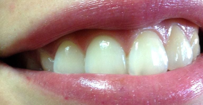 consejos para mantener una salud bucodental adecuada