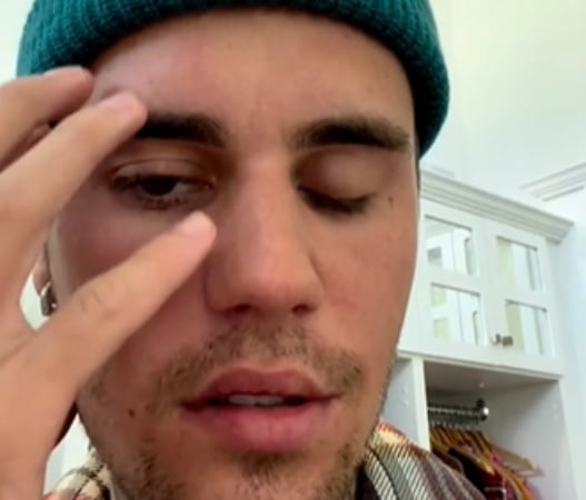 Justin Bieber anuncia la cancelación de sus conciertos en Instagram por la parálisis facial que sufre